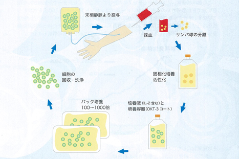 活性化自己リンパ球療法治療イメージ