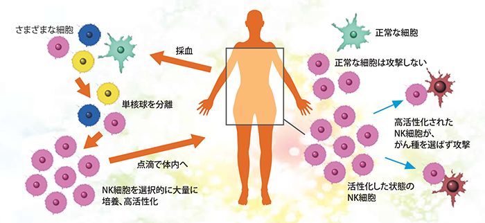 ナチュラルキラー細胞の働きイメージ